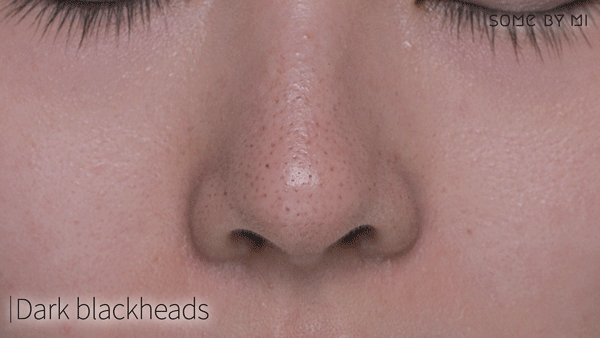 SOME BY MI Miracle Bye Bye 30 Days Blackhead Miracle Green Tea Tox Bubble Cleanser